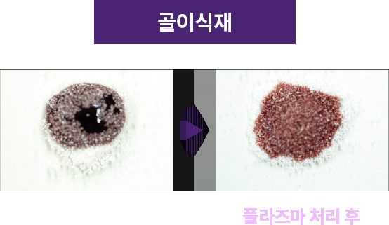 골이식재 — 플라즈마 처리 전후